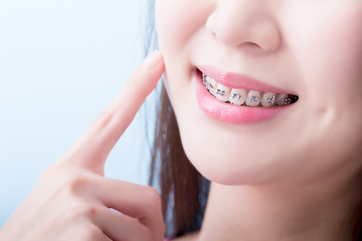 若い女性におすすめの矯正治療。見た目も気にならない歯科矯正はある？